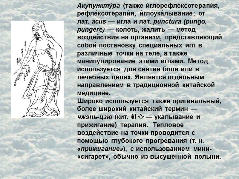 Акупункту́ра (также и́глорефле́ксотерапи́я, рефле́ксотерапи́я, и́глоука́лывание; от лат. acus — игла и лат. punctura (pungo,